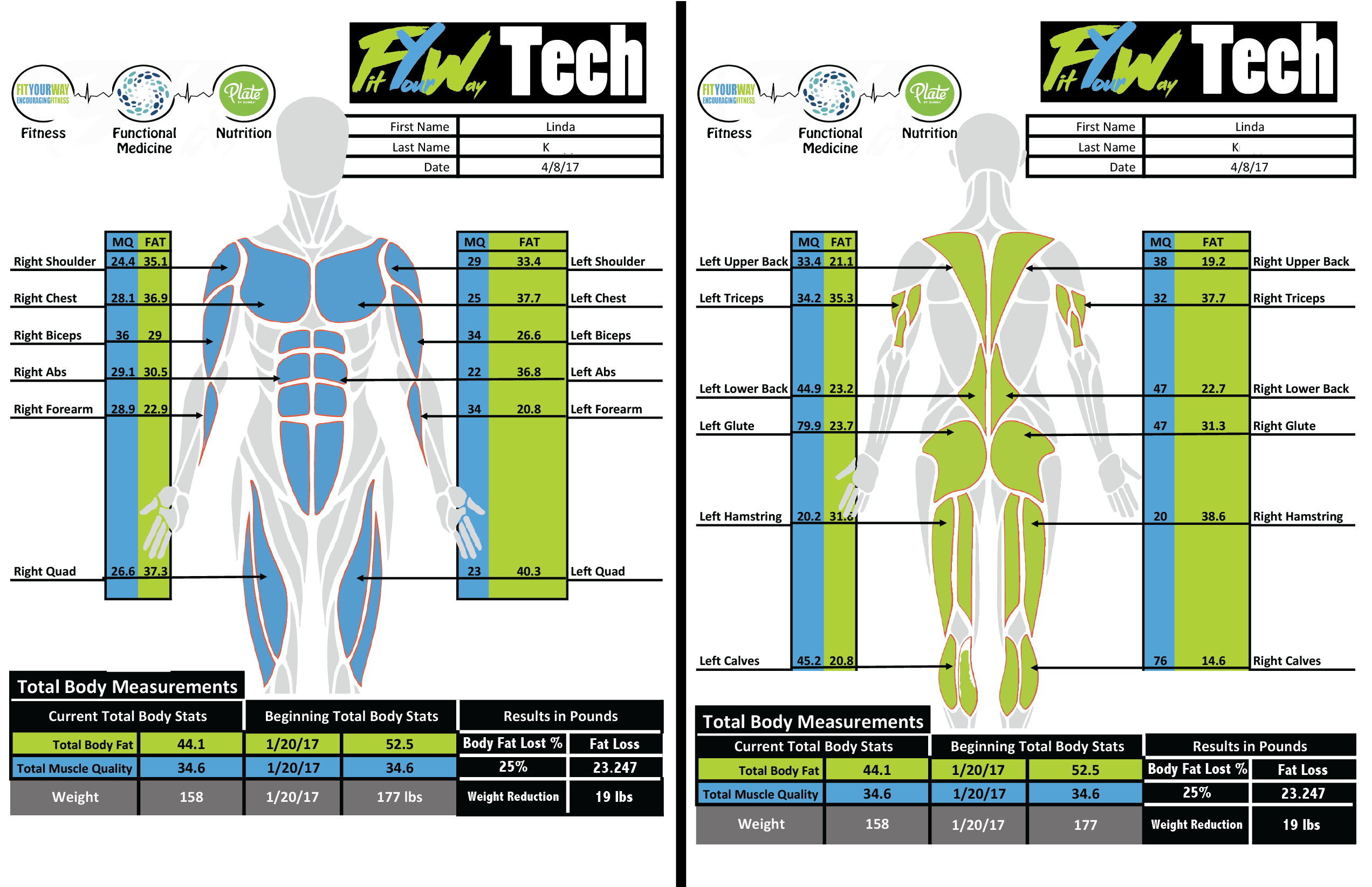 SKULPT-FYW Tech.png